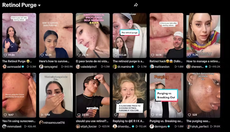TikTok retinol purge.