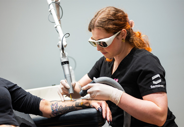 Woman removing a tattoo from a client's arm.