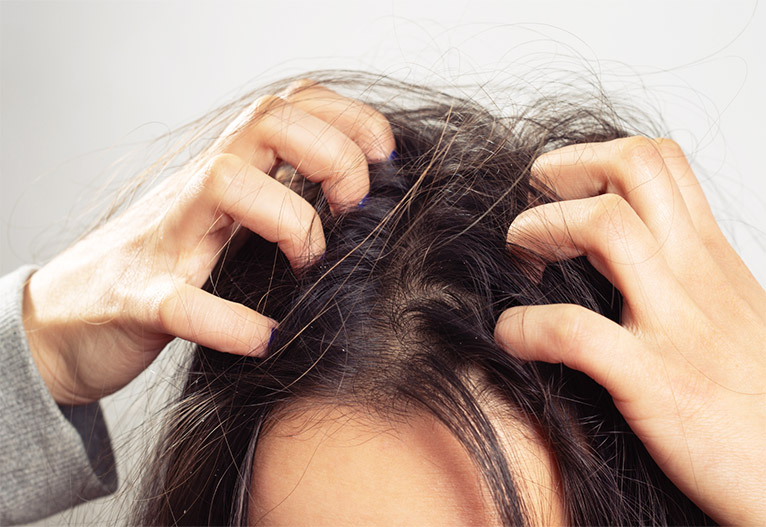 Person with irritated scalp.