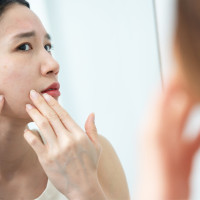 Concerned woman looking at her skin in a mirror.