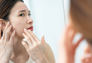 Concerned woman looking at her skin in a mirror.